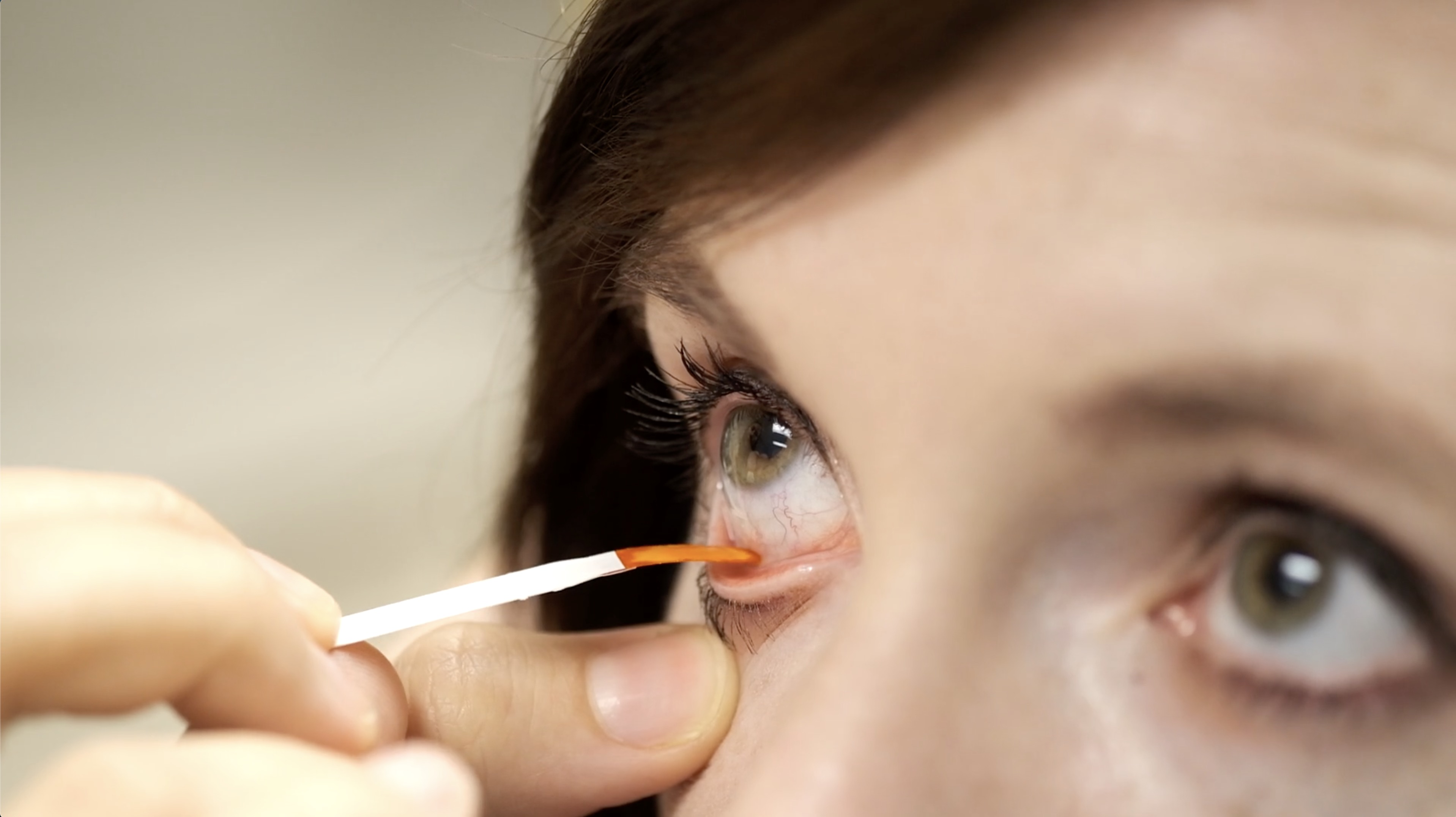 Fluorescein Exam